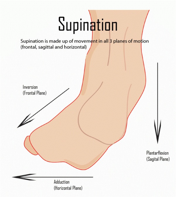 chan-lech-ngoai-supination